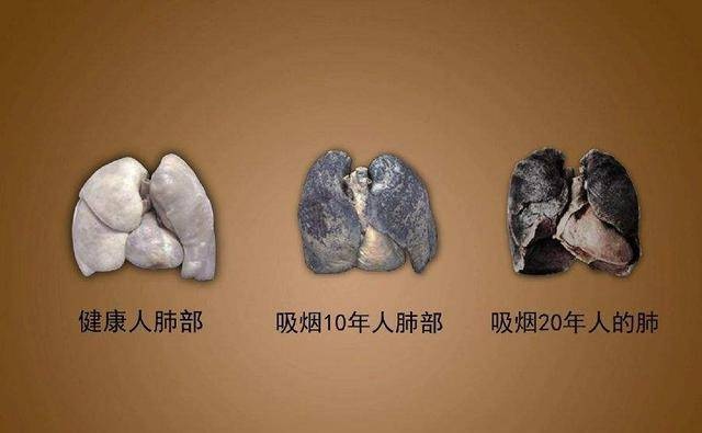 戒烟后肺部恢复的旅程，10年烟龄者的希望之路一手货源 - 3 - 635香烟网